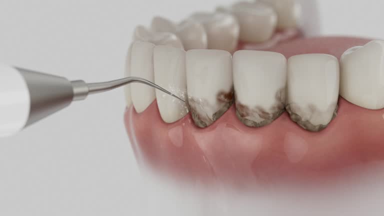 Reliable Dental contractor in Canfield, OH by Dentist Open Now